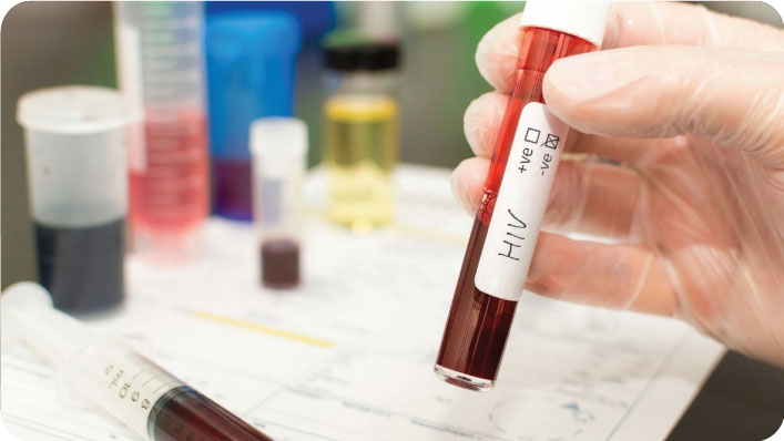 HIV Test